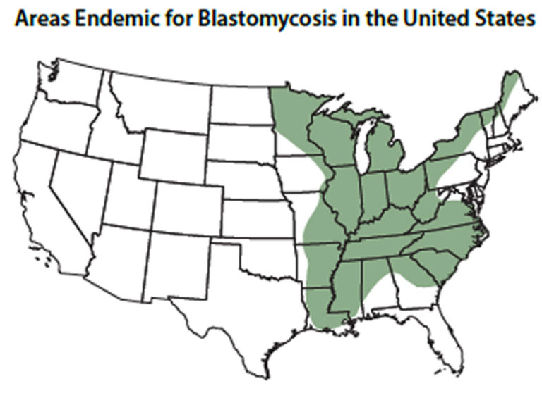 Blastomycosis in humans causes, symptoms, diagnosis and treatment