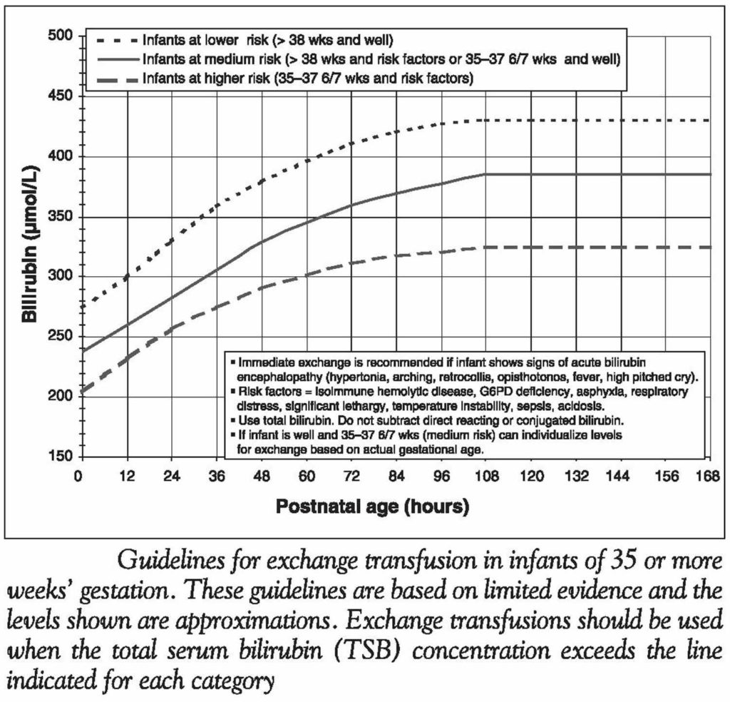 Kernicterus in newborn causes, signs, symptoms, diagnosis and treatment