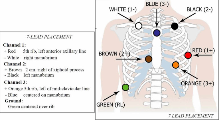 Holter monitor uses, instructions, preparations and Holter monitor results