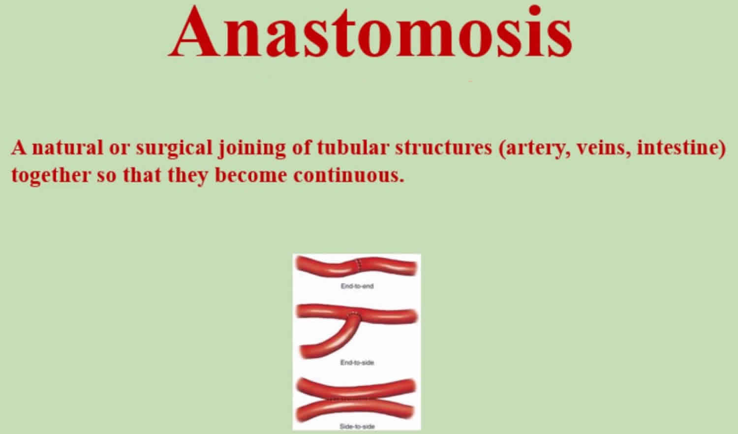 anastomosis