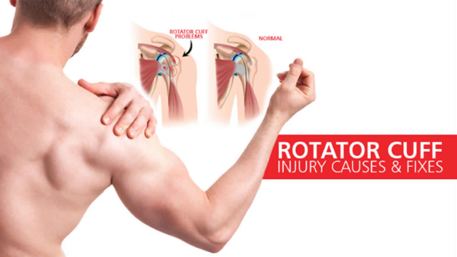 symptoms of rotator cuff problems