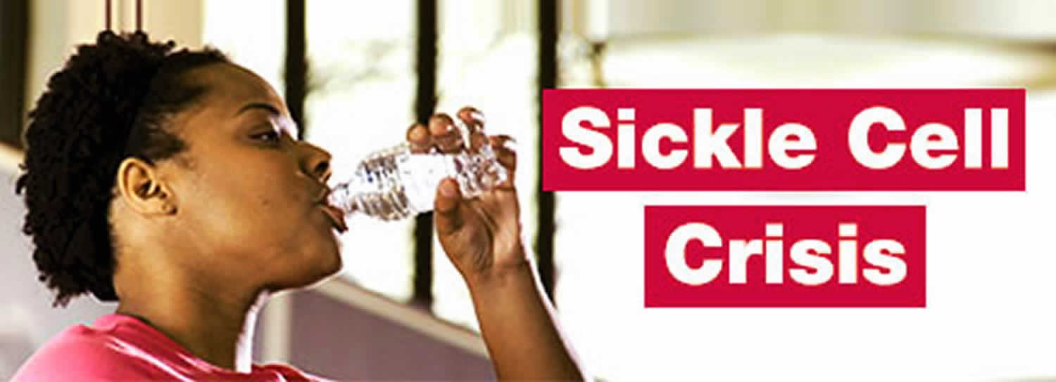 How Can Sickle Cell Crisis Be Treated