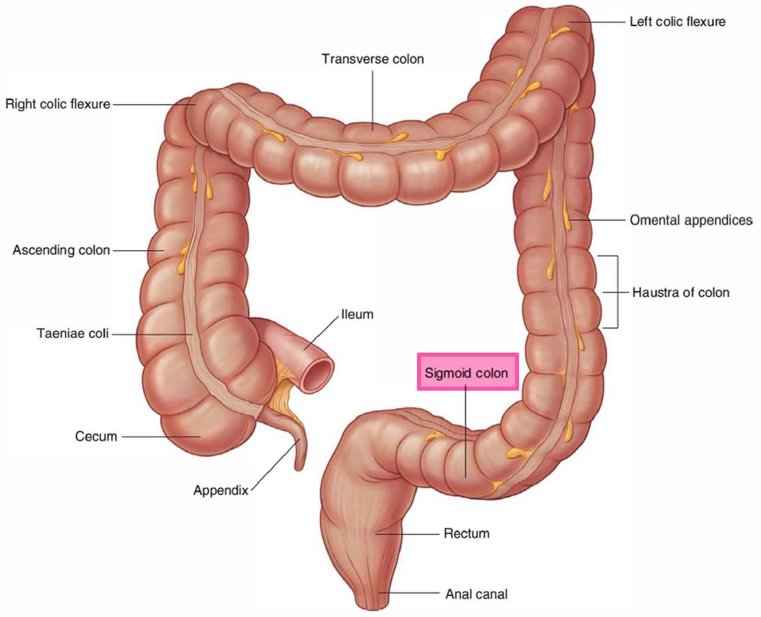 How Much Is Colon Surgery