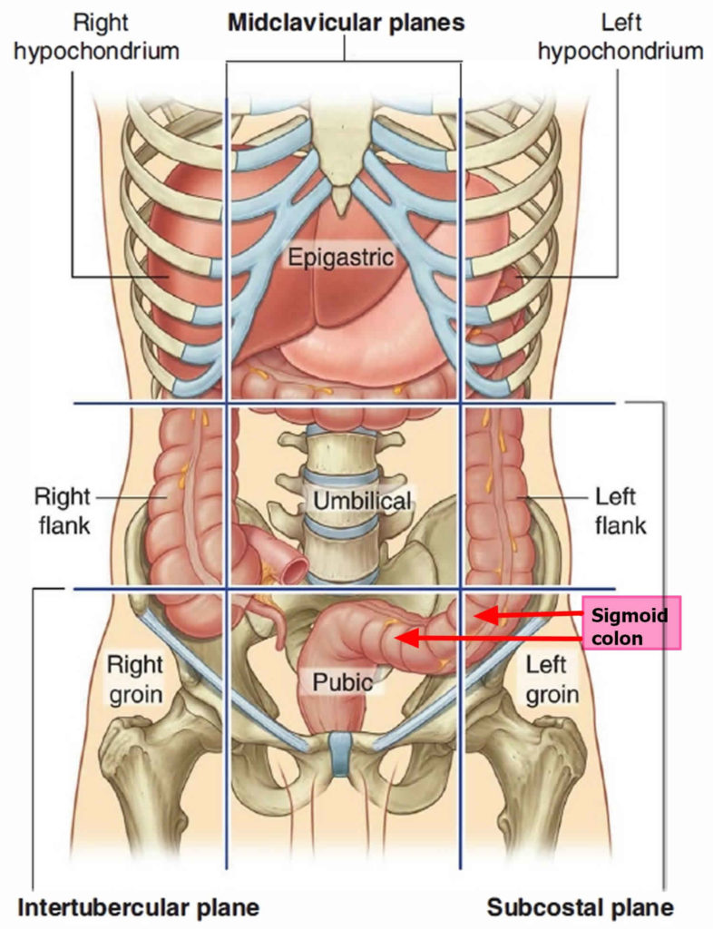 sigmoid-colon-anatomy-location-function-polyps-diverticulosis-cancer