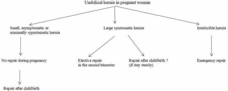 Umbilical hernia in newborn, pregnancy & adults, symptoms & treatment