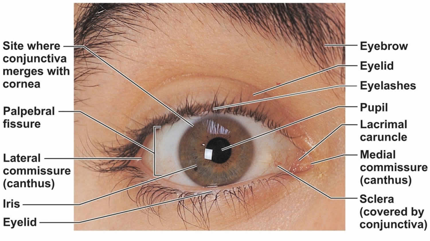 pinguecula-eye-causes-symptoms-diagnosis-pinguecula-eye-treatment