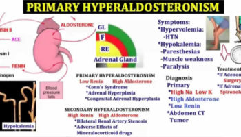 hyperaldosteronism