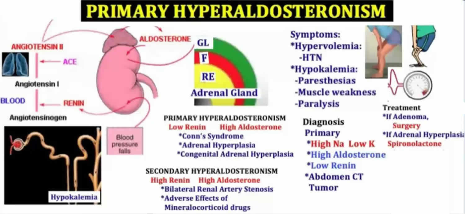 Aldosterone Potassium