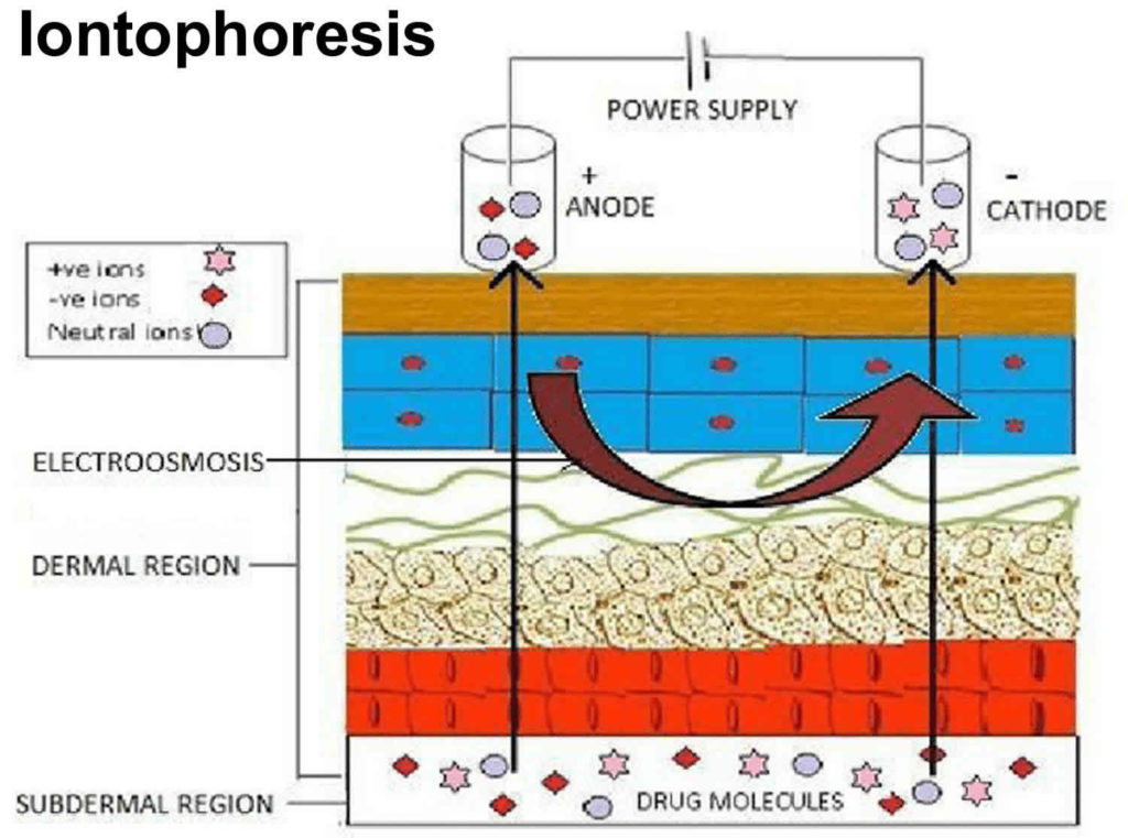 Iontophoresis treatment, physical therapy, medication & side effects