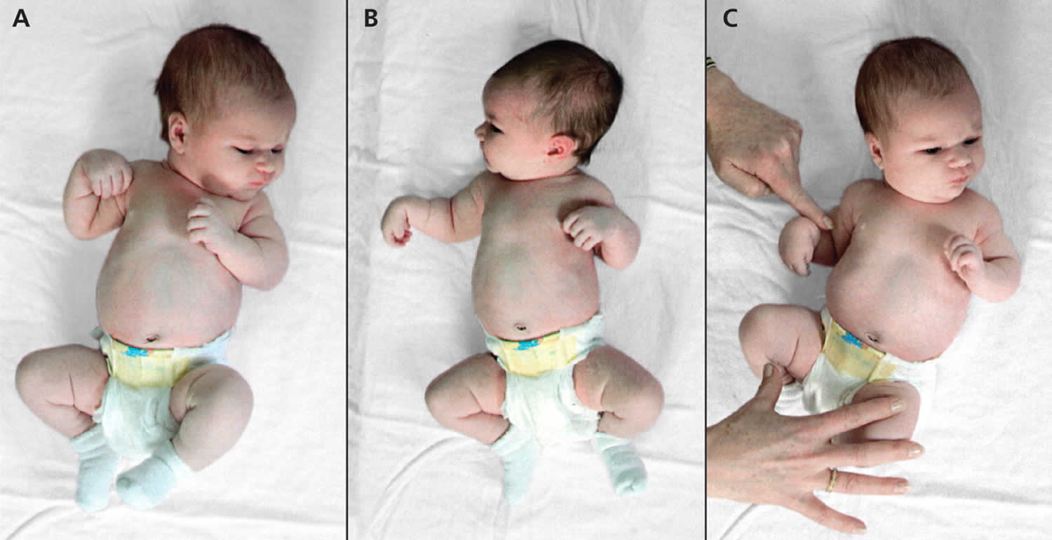 Radial Nerve Anatomy, Radial Nerve Palsy And Radial Nerve Injury