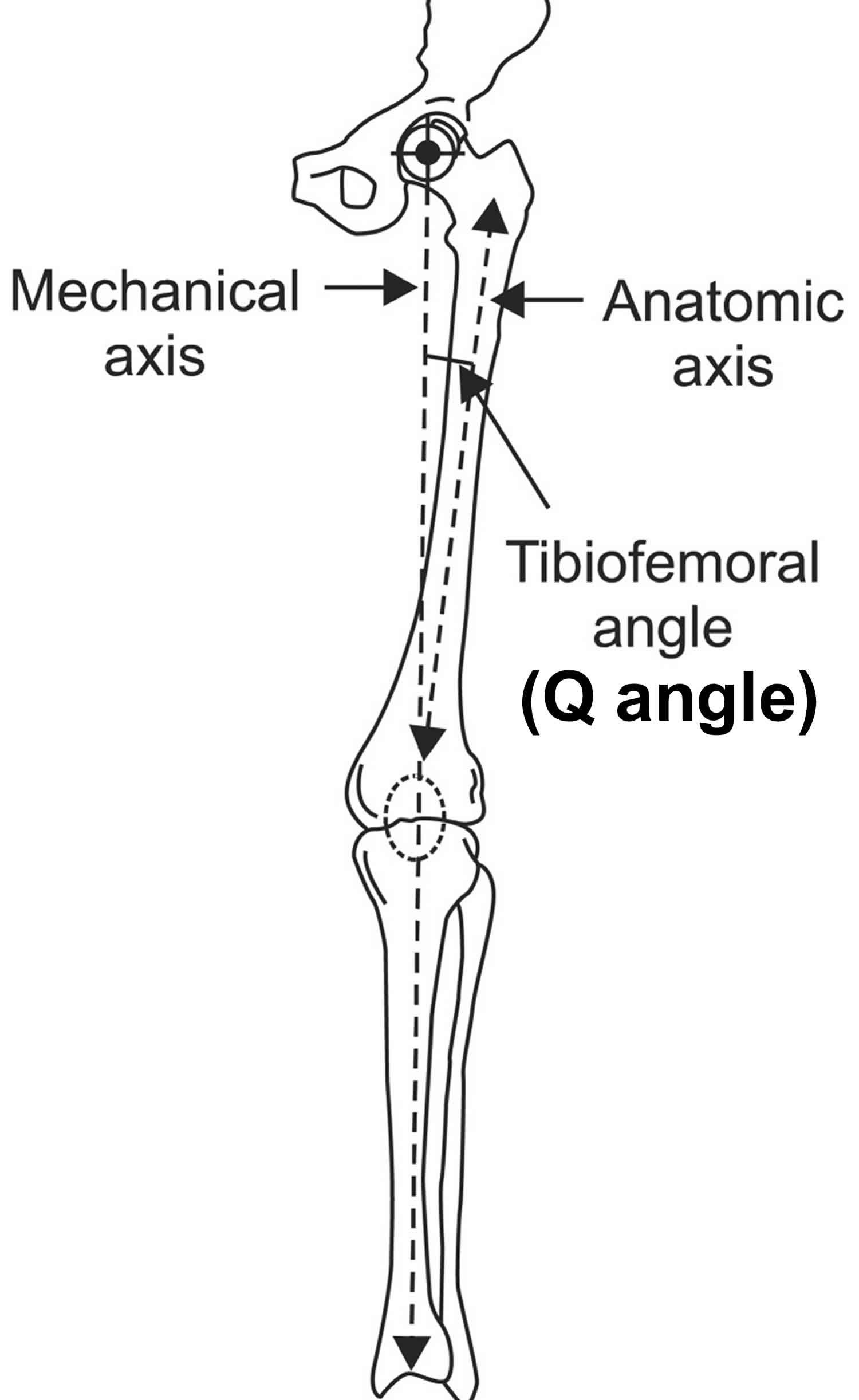Knock knees causes, signs, symptoms, diagnosis & knock knees treatment