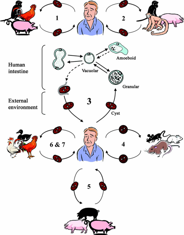 Blastocystis & blastocystis hominis, causes, symptoms, diagnosis ...