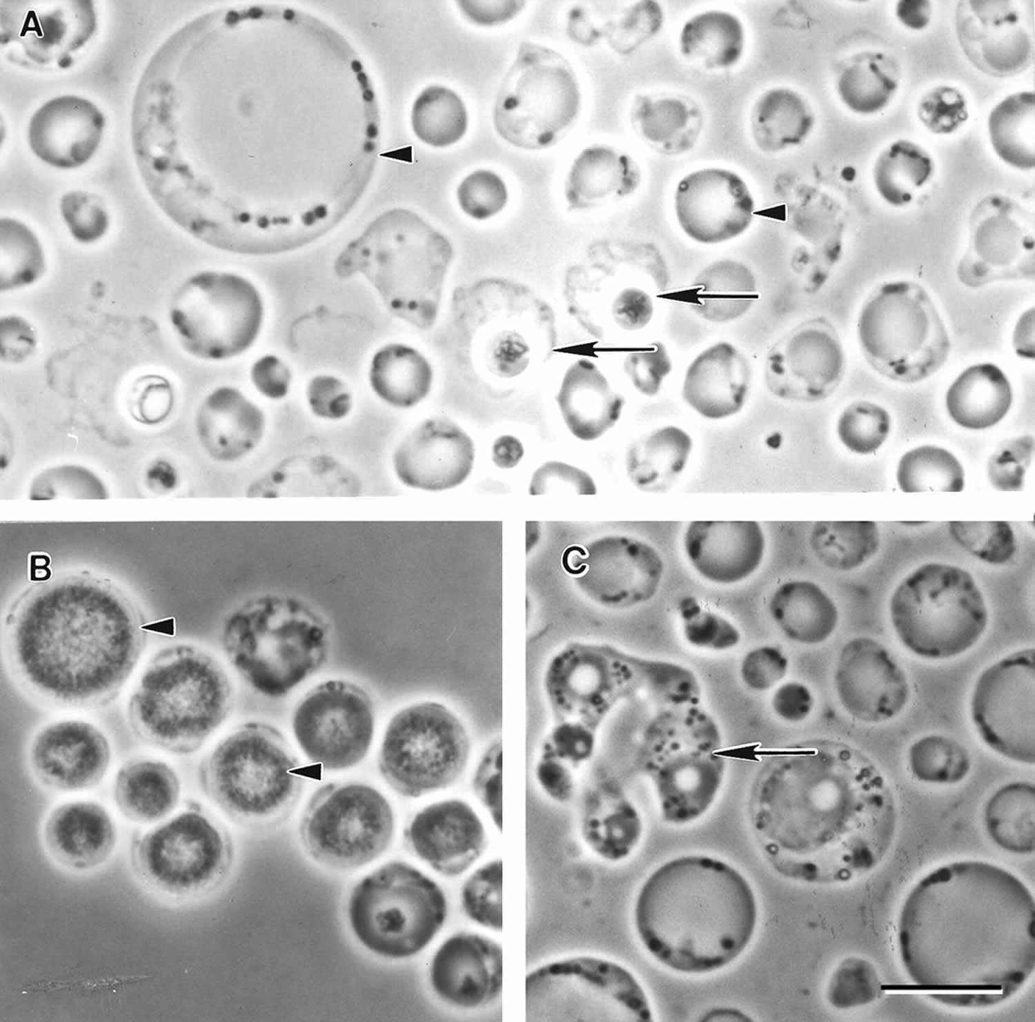 รายการ 98+ ภาพ Blastocystis Hominis การ รักษา ความละเอียด 2k, 4k