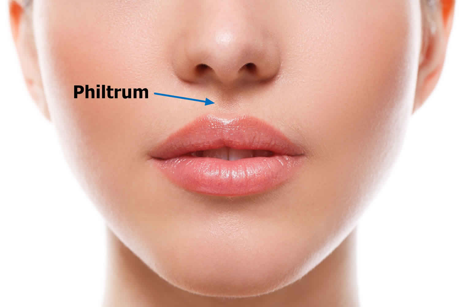 Philtrum of lip, causes of smooth philtrum, long or short philtrum