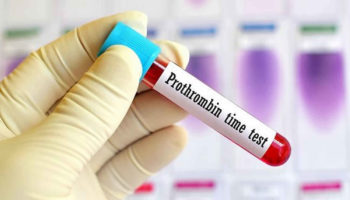 prothrombin time test