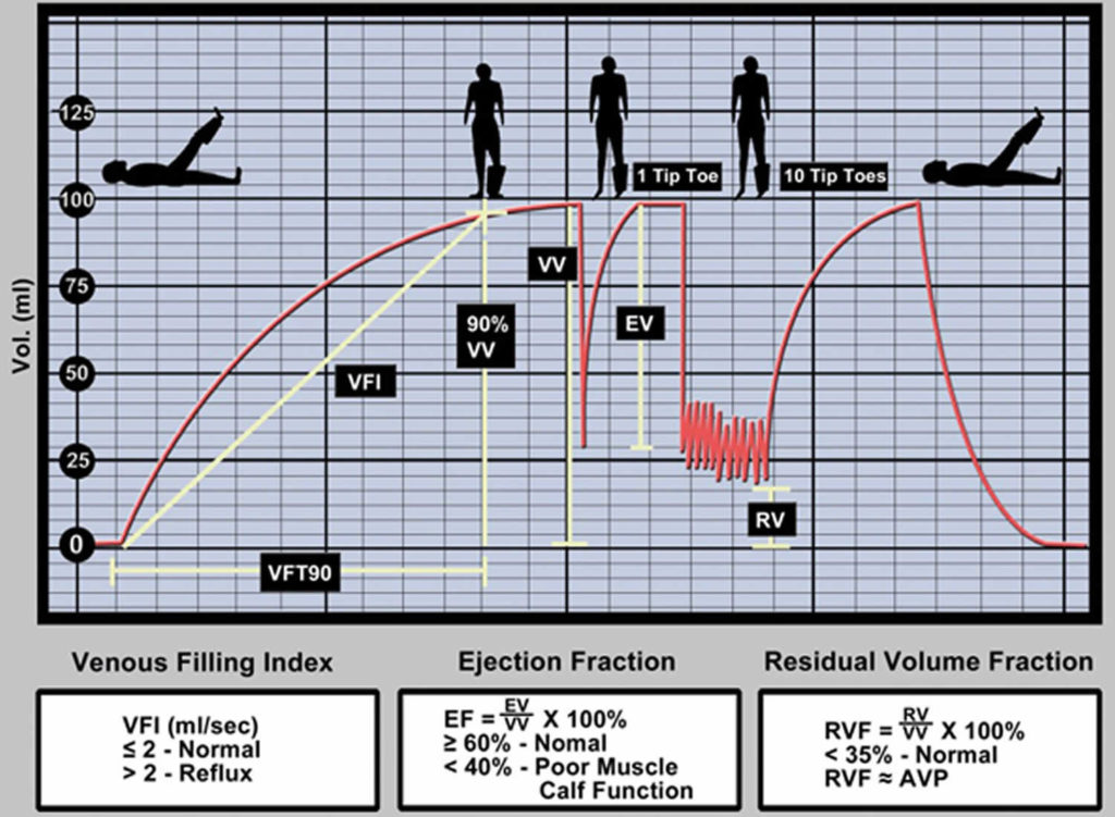 Whole-body Plethysmography, Air Plethysmography & Pulse Plethysmography