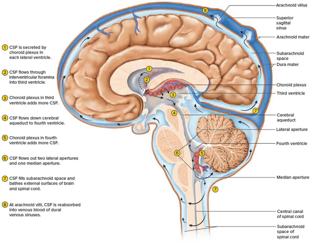 blood in spinal fluid in brain