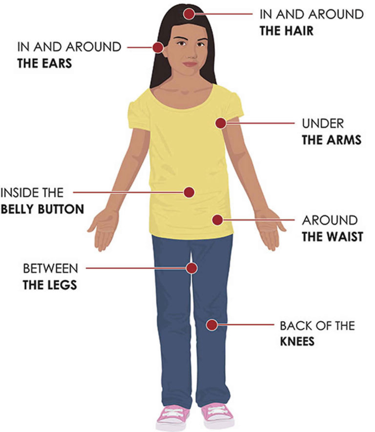 Relapsing fever definition causes symptoms diagnosis amp treatment