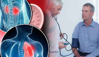 Goodpasture syndrome