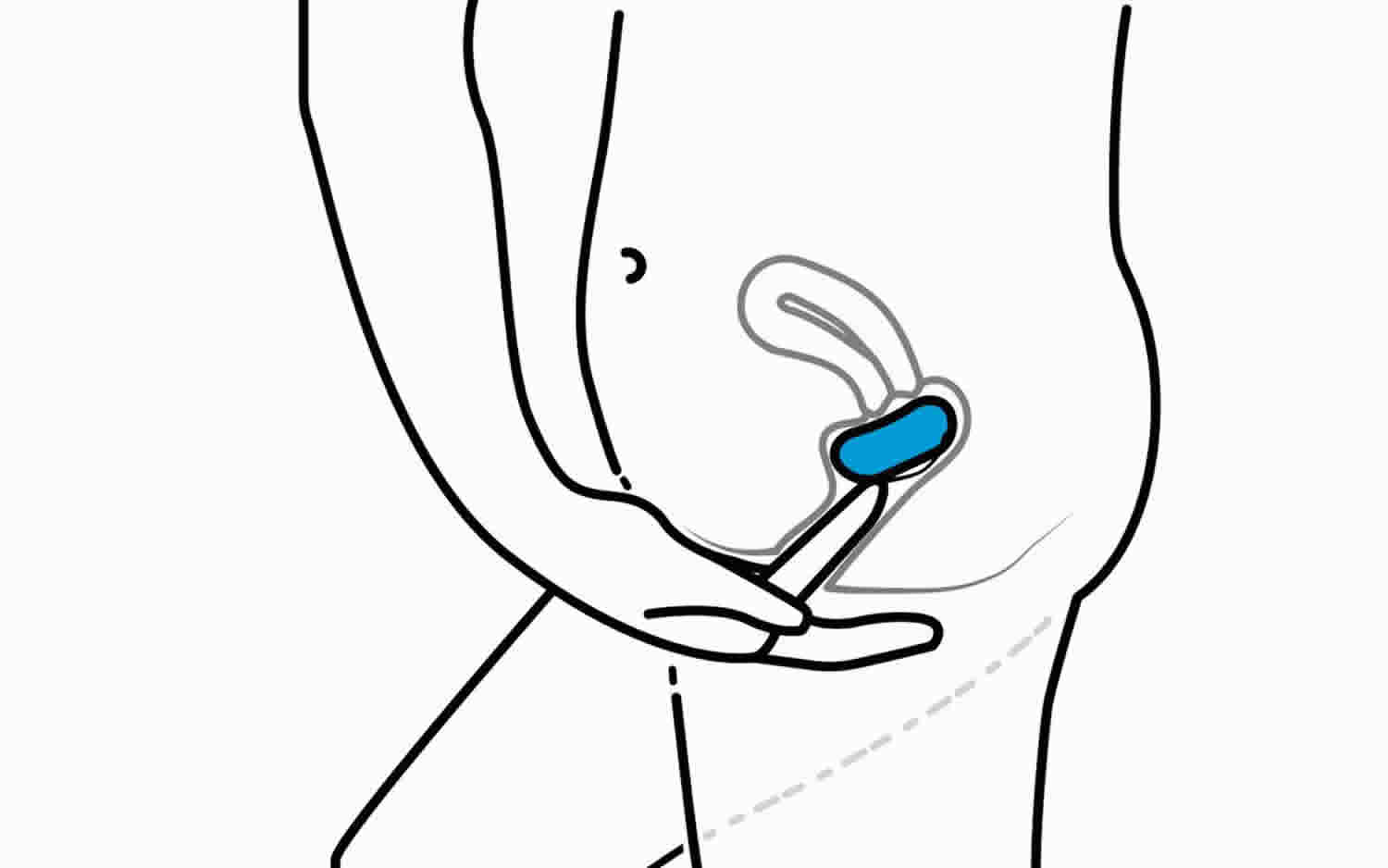 Birth control sponge, contraceptive sponge, how to use, effectiveness