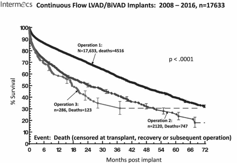 LVAD, left ventricular assist device procedure, life