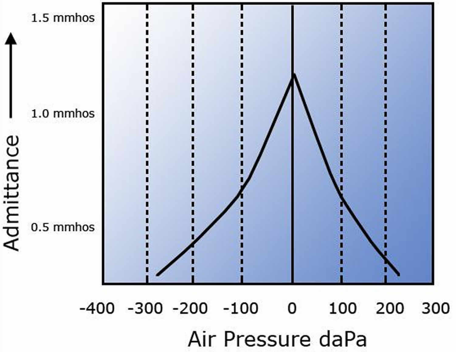 Tympanometry test, tympanometry types & abnormal tympanometry results