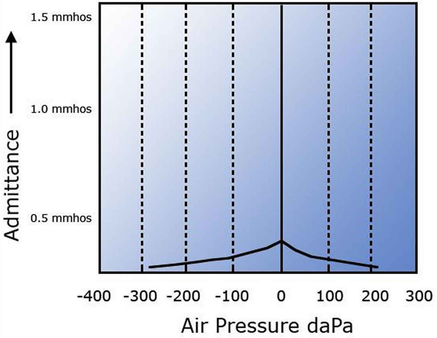 Tympanometry test, tympanometry types & abnormal tympanometry results