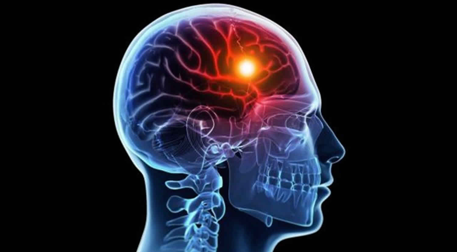 Cerebral hypoxia, brain hypoxia causes, symptoms, treatment & prognosis