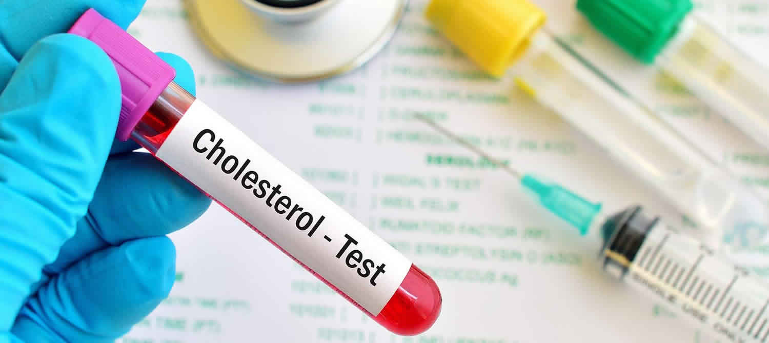 What Test Determines High Cholesterol