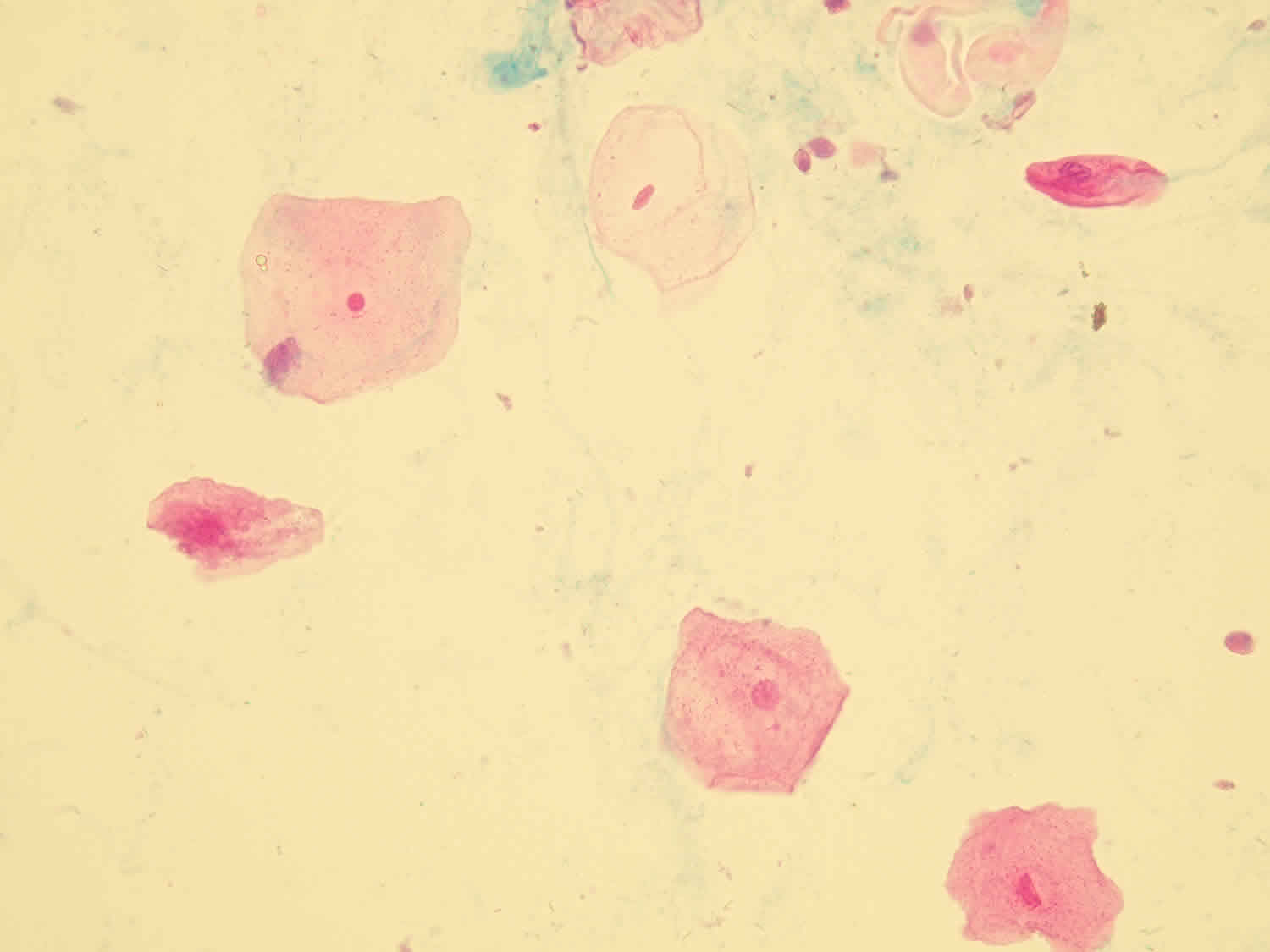 Epithelial Cells In Urine What Does It Mean If You Have Epithelial Cells In Urine 3057