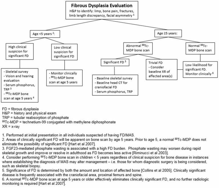 Fibrous dysplasia causes, symptoms, diagnosis, treatment & life expectancy