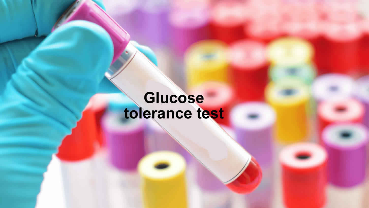 Glucose tolerance test