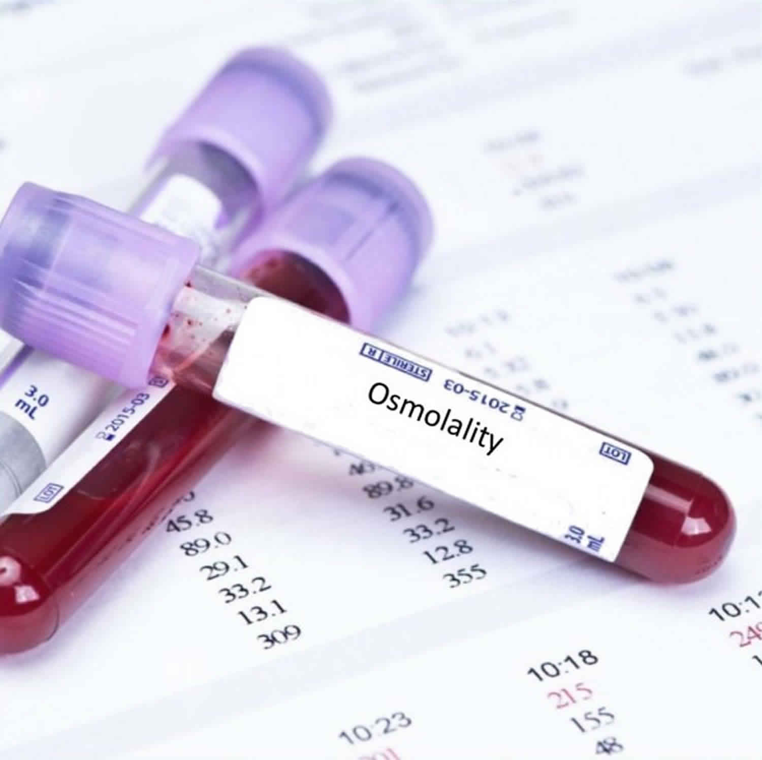 serum osmolarity