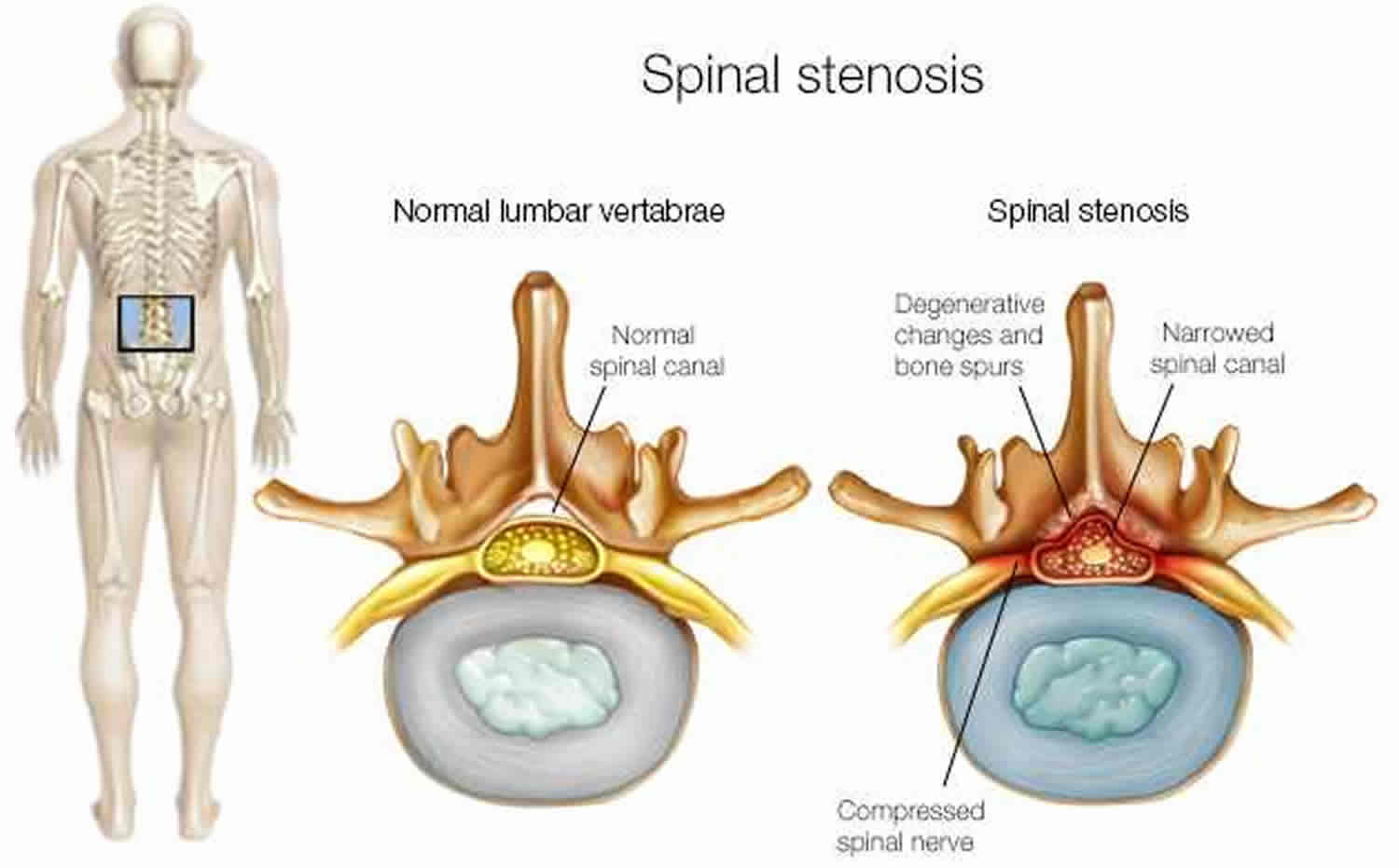 lumbar region of back