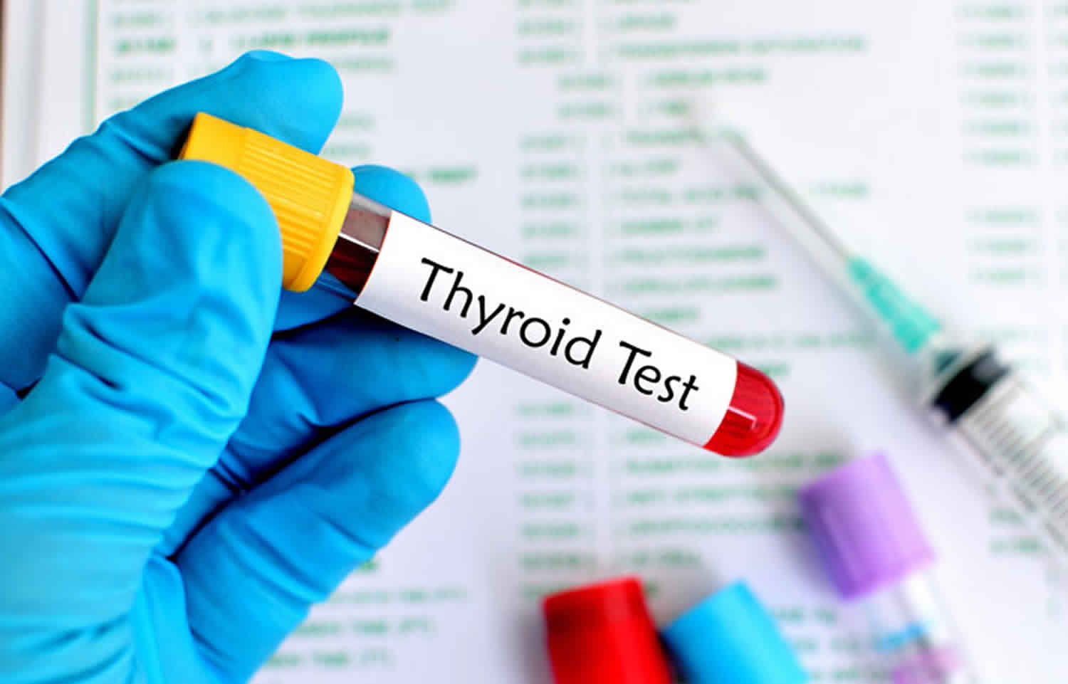 Thyroid Blood Test Thyroid Function Test Normal Values Results 