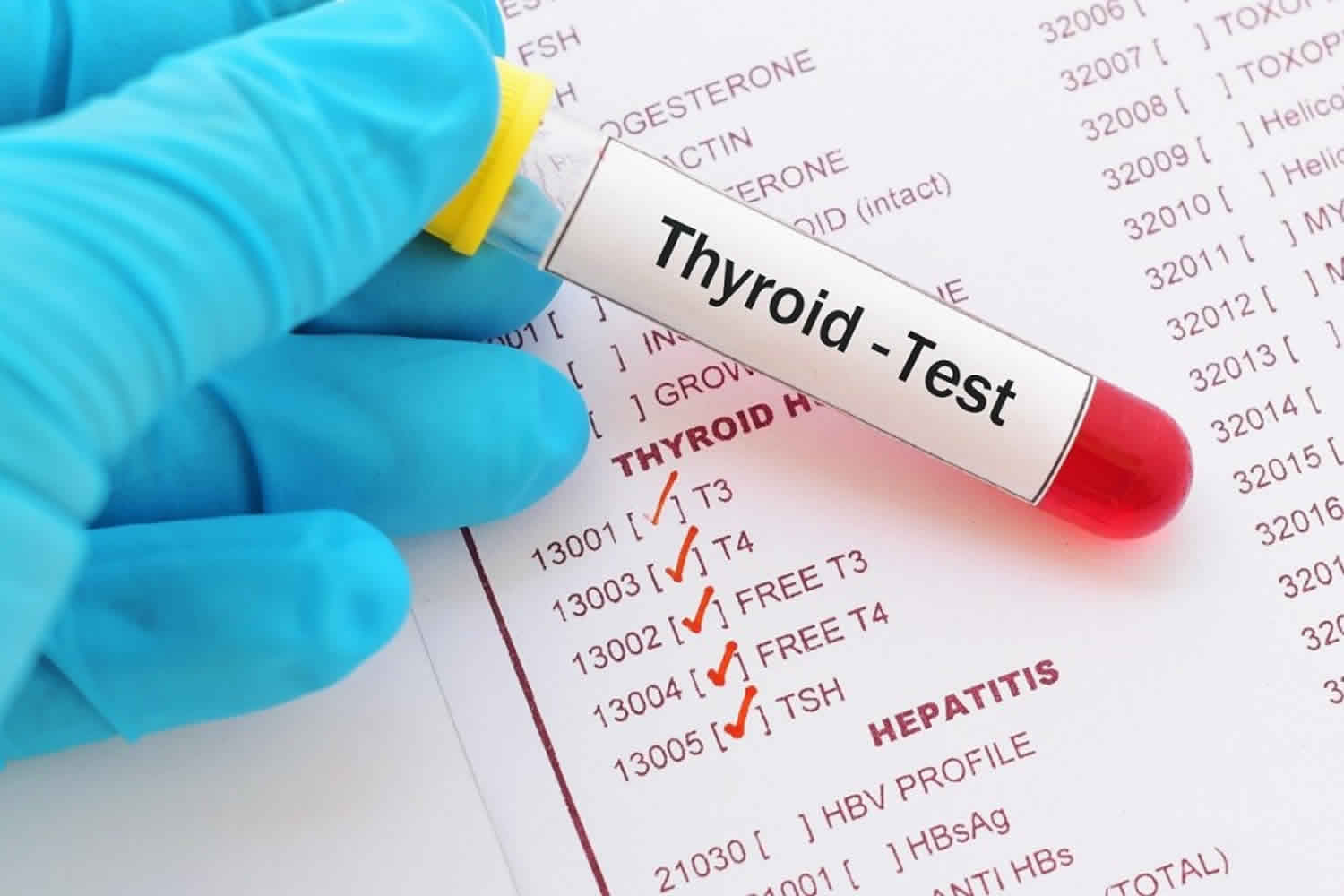 thyroid-peroxidase-function-thyroid-peroxidase-antibody-test