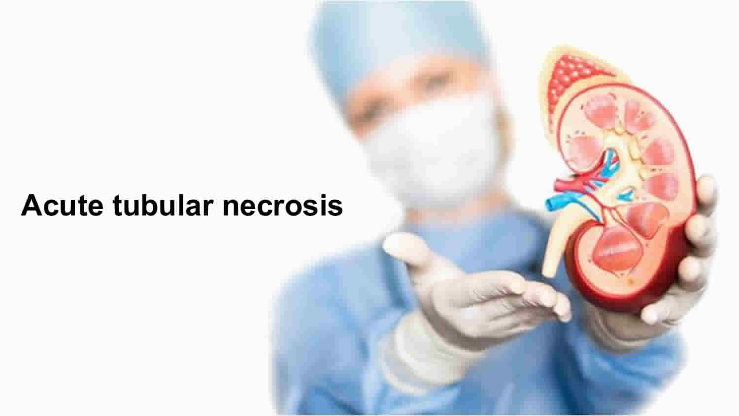 Acute tubular necrosis causes, symptoms, diagnosis & treatment