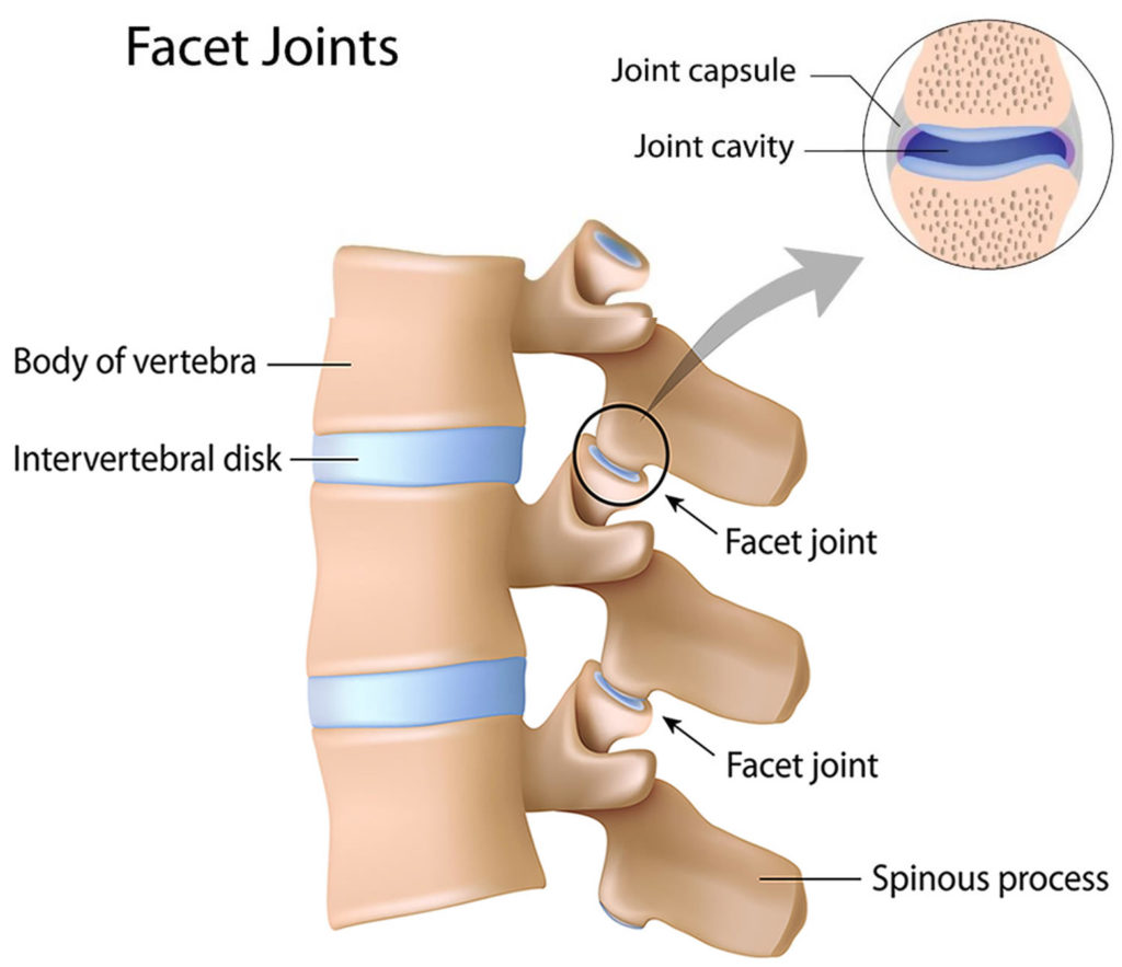 facet-joint-injuries-my-family-physio