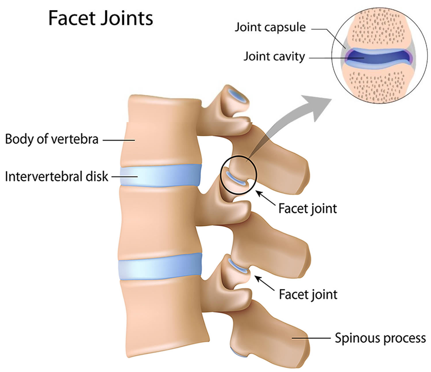 arthropathy-definition-facet-arthropathy-lumbar-facet-arthropathy