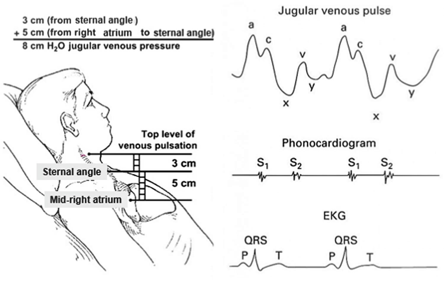 Jugular vein, internal and external jugular vein anatomy, location & function