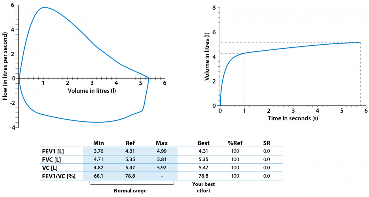 Spirometry test, spirometry results & spirometry interpretation