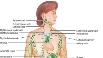 adenopathy