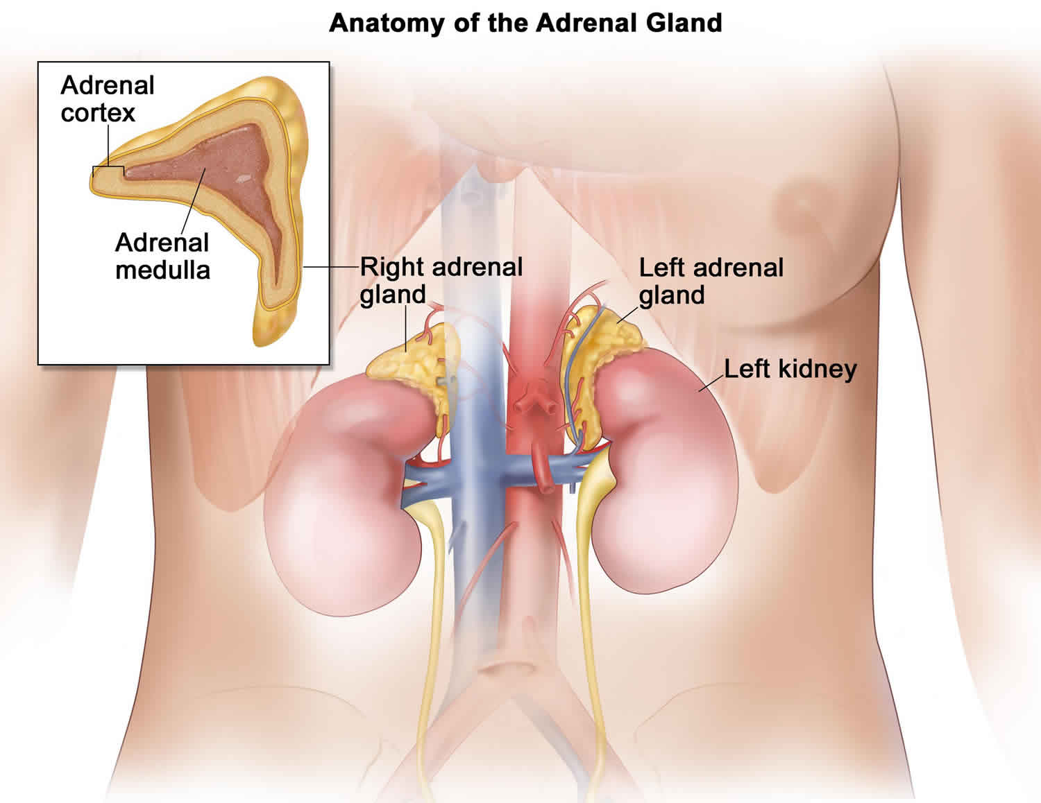 adrenal adenoma