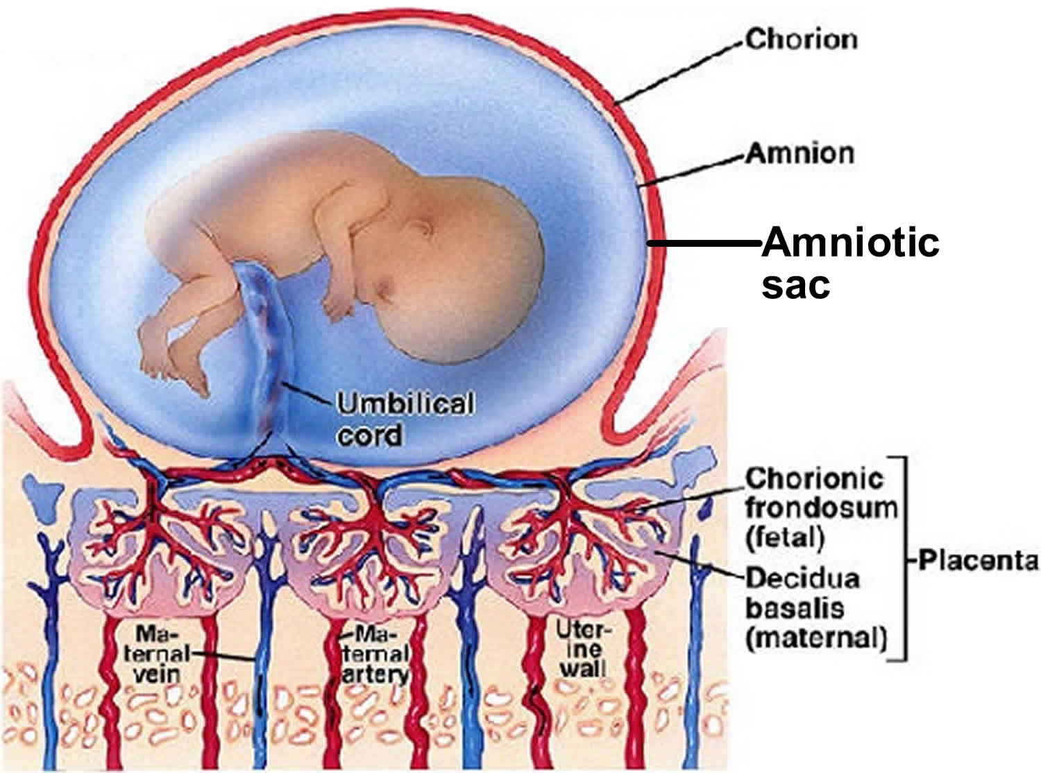 What Causes Gestational Sac In Pregnancy