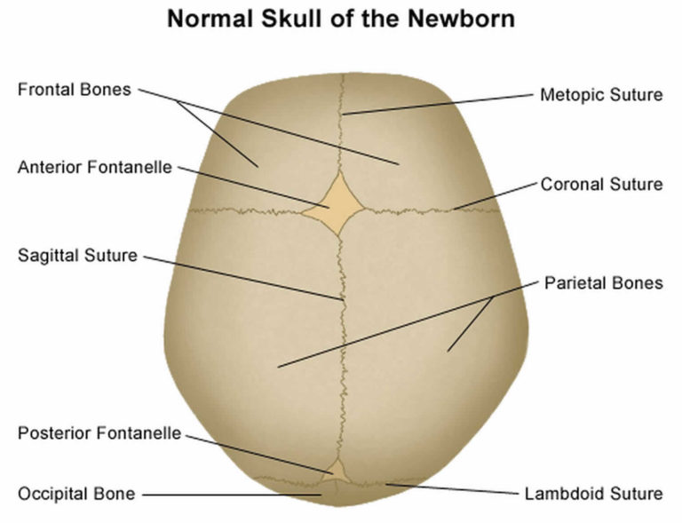 Flat head syndrome causes, prevention, symptoms, diagnosis & treatment