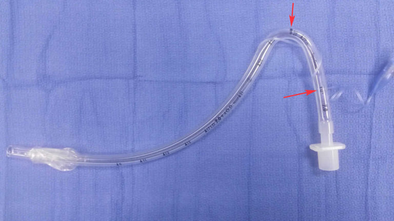 Intubation definition, endotracheal intubation, nasal intubation