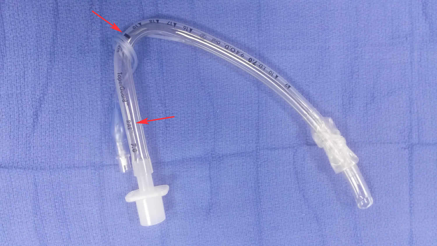 Intubation definition, endotracheal intubation, nasal intubation