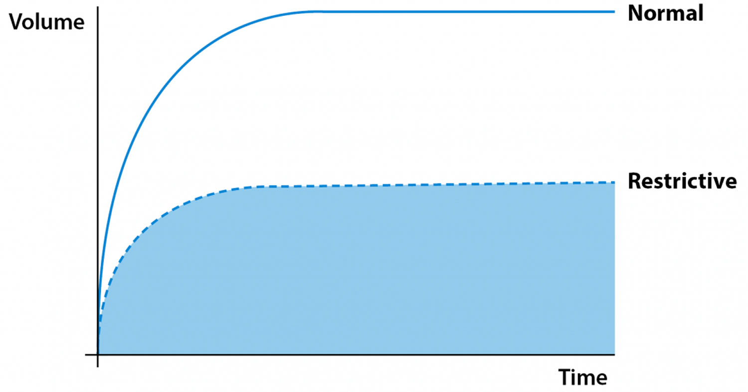 restrictive lung disease spirometry