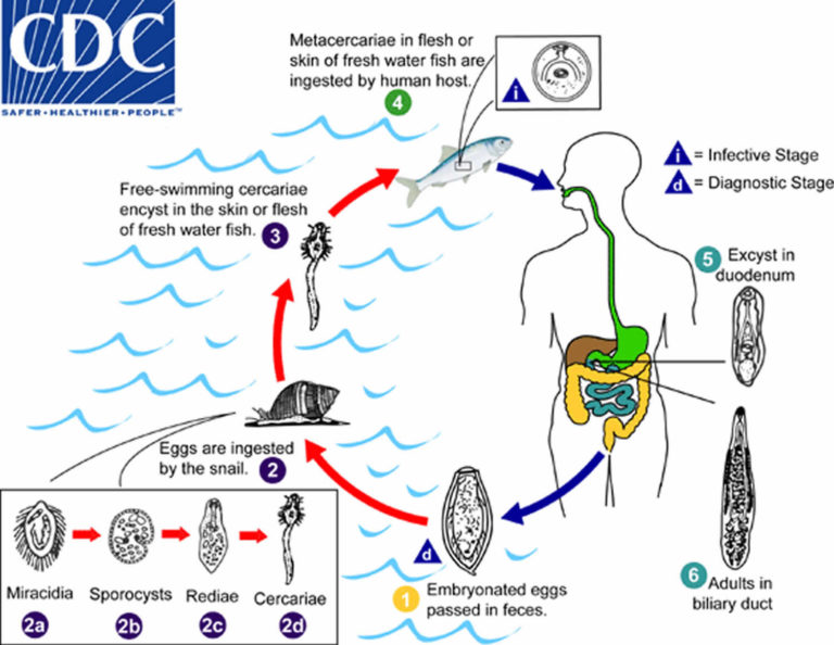 Human Liver Fluke Infection Liver Fluke Life Cycle Symptoms And Treatment 6773