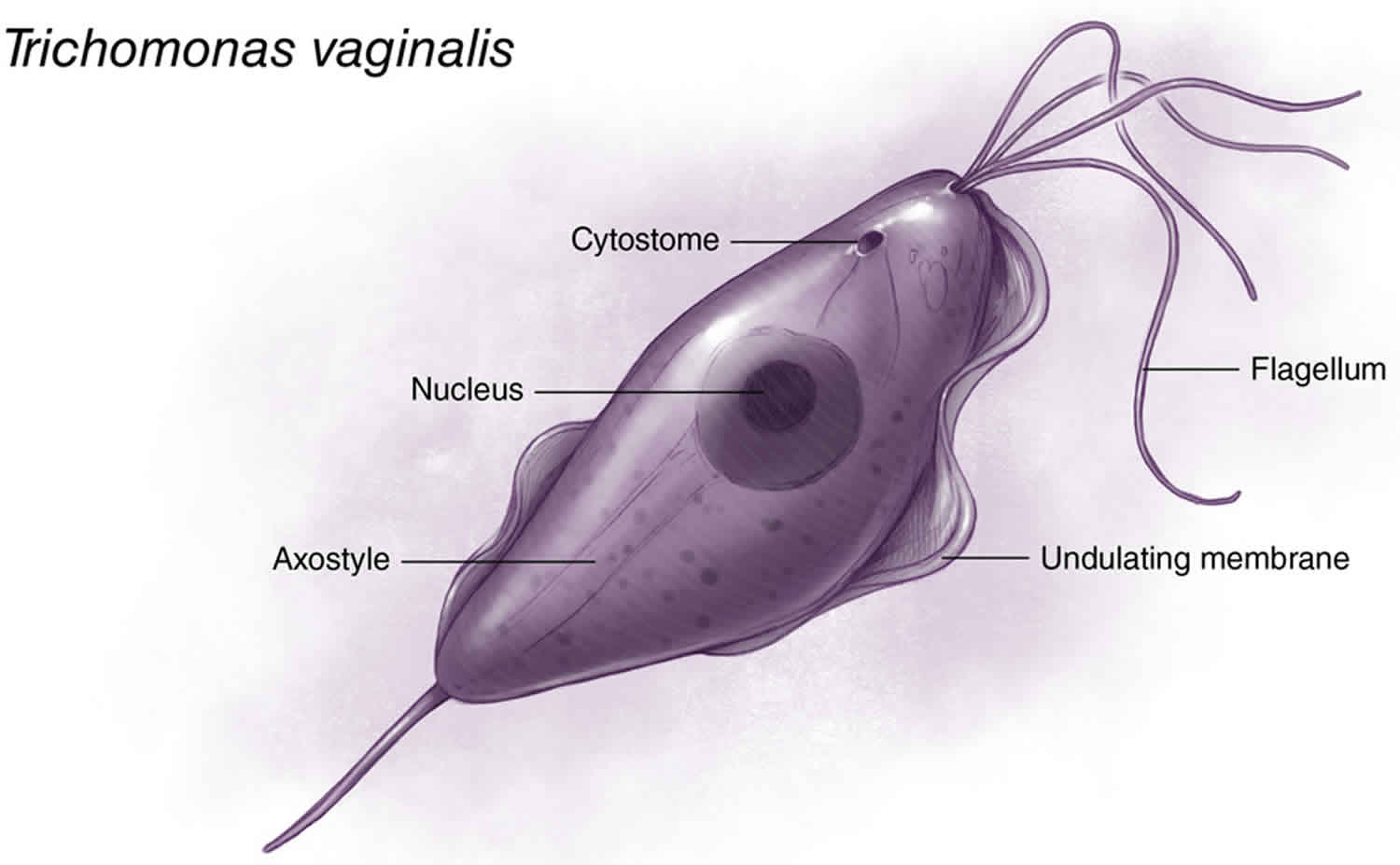 Trichomoniasis vagy Genitalis Trichomonas vaginalis fertőzés
